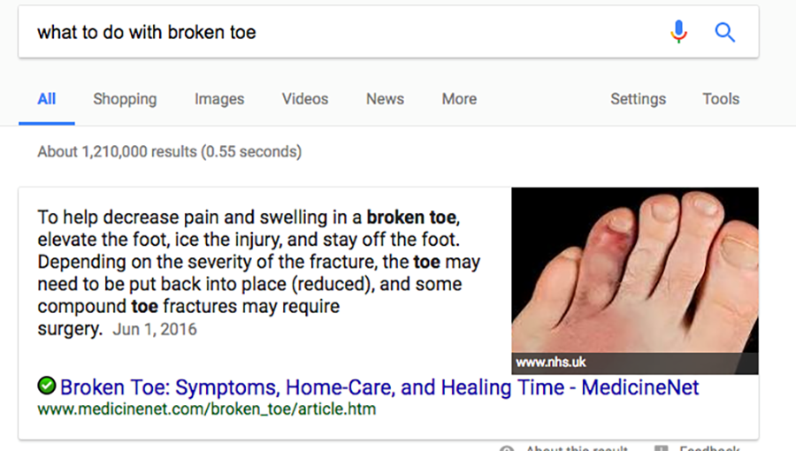 what to do with broken toe google search