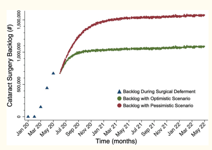 Cataract Surgery Backlog